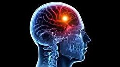 مهمترین اقدام درمانی برای افراد مبتلا به سکته مغزی چیست؟