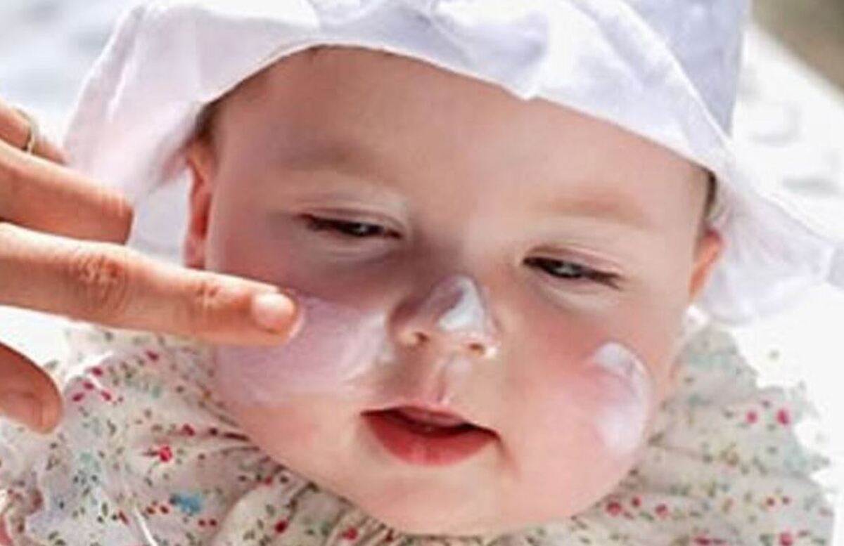 مراقبت از کودکان در برابر آفتاب سوختگی را جدی بگیرید