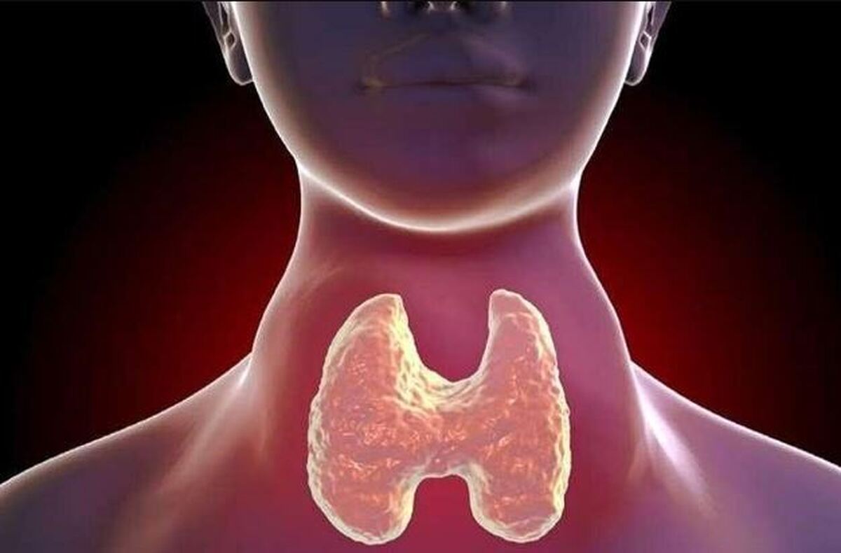 علت کاهش اثر دارو‌های تیروئیدی چیست؟