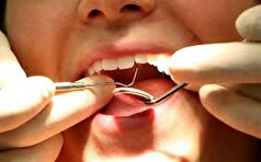 ارتباط بین استرس و افزایش مشکلات سلامتی دهان و دندان!