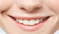 آدامس بدون قند، نوشدارویی برای بوی ناخوشایند دهان؟