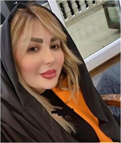چهره کتک خورده و پر از زخم و کبودی نیوشا ضیغمی در پشت صحنه یک فیلم مورد توجه قرار گرفت