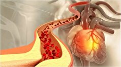 کاهش و مدیریت کلسترول خون به کمک این ادویه