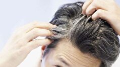 آب پیاز برای رشد مو چه تاثیری دارد؟
