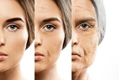 جلوگیری از پیری پوست با روش‌های ساده