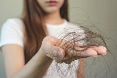 به این دلیل موهایتان میریزد!