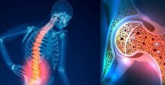استارت پوکی استخوان از این سن کلید می‌خورد