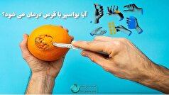 معرفی بهترین قرص برای درمان بواسیر!