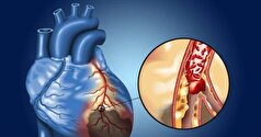 ‌می‌توان از گرفتگی عروق قلبی پیشگیری کرد؟