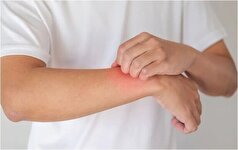 بهترین راه برای مقابله با پیشرفت بیماری اگزما