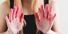 چند ترفند ساده و طلایی برای پاک کردن رنگ مو از روی پوست دست و صورت