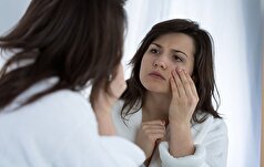 تیرگی زیر چشم قابلیت رفع شدن دارد؟