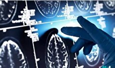 جینسینگ؛ دشمن درجه یک آلزایمر