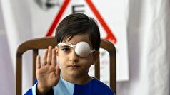 معرفی زمان طلایی تشخیص تنبلی چشم!