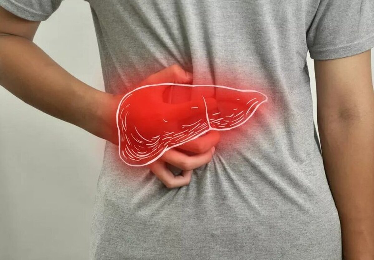 بیماری کبد چرب را اینگونه کنترل کنید!
