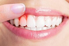 بیماری‌های دهان و دندان با این علائم ظاهر میشوند!