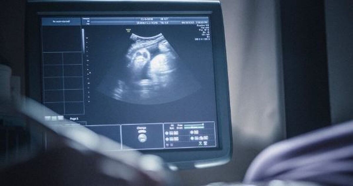 زمان دقیق تشکیل شدن قلب جنین پسر و دختر / عوامل تاثیر گذار برای شنیدن قلب جنین