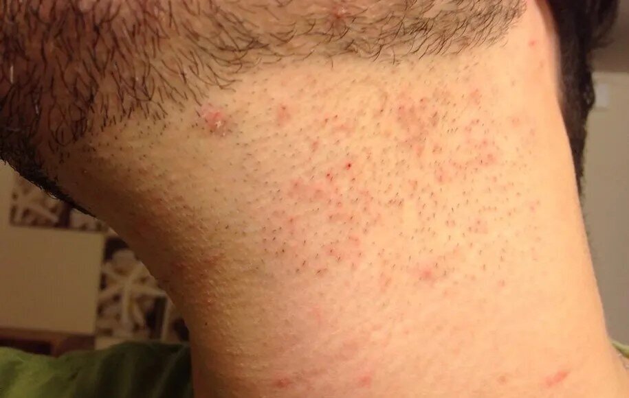 مراقبت‌های پس از اصلاح برای داشتن پوستی سالم و صاف/ویژه آقایان!
