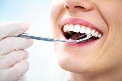 تغییر رنگ دندان نشانه چه بیماری است؟