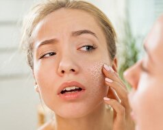 راز داشتن پوستی نرم در دوران بارداری با ترفند‌های خانگی
