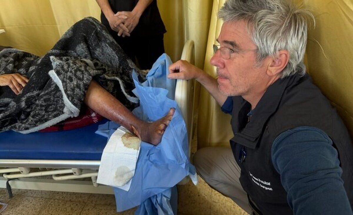 ناگفته‌های پزشک انگلیسی متخصص سوختگی از کودکان سوخته غزه