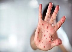 این دو بیماری خطرناک به طور کامل از ایران حذف شدند!