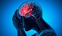 بیماریی که باعث خون ریزی مغزی می‌شود را بشناسید
