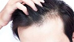 مصرف این خوراکی‌ها سلامت مو را بهبود می‌بخشد
