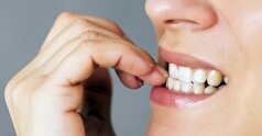 راهکار‌های پیشگیری از جویدن پوست لب و ناخن!