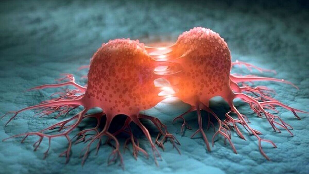 درد زیر جناغ سینه چه علتی دارد؟ چه زمانی خطرناک است؟