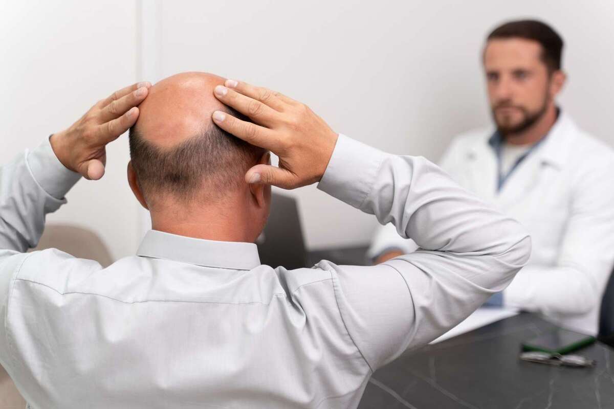 روشی برای درمان طاسی با استفاده از یک پچ مخصوص حاوی میکرونیدل ایجاد شده است