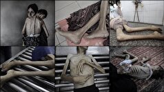 جان باختن ۱۳ فلسطینی در ۲۴ ساعت درپی قحطی