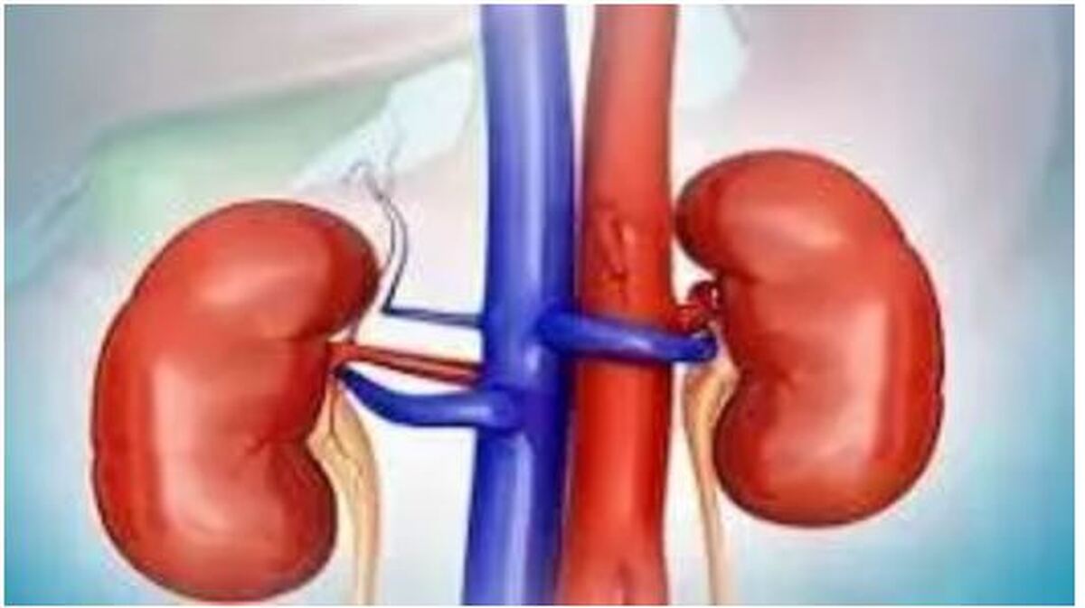 مصرف مشروبات الکلی باعث دفع سنگ کلیه می‌شود؟