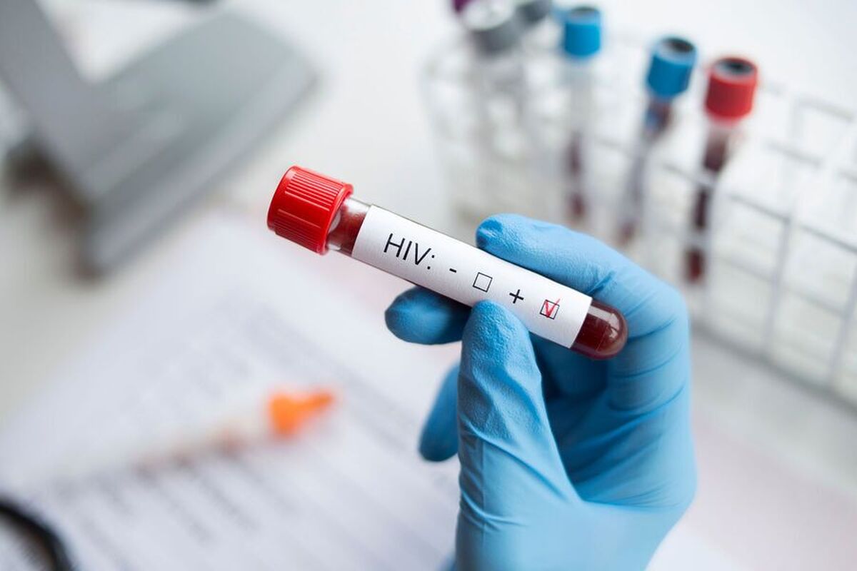 دانشمندان راهی برای تشخیص ویروس HIV پنهان در بدن پیدا کرده‌اند