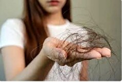 نقش کمبود‌های تغذیه‌ای و هورمونی بر ریزش مو