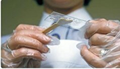 با آزمایش ساده پاپ اسمیر از سرطان دهانه رحم جلوگیری کنید