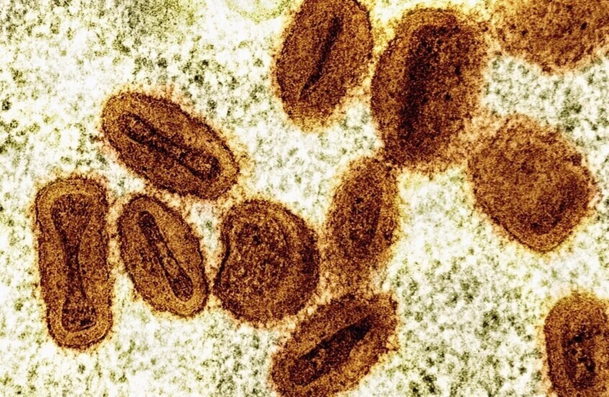 سازمان بهداشت جهانی: آبله میمونی دیگر یک وضعیت اضطراری بهداشتی بینالمللی نیست