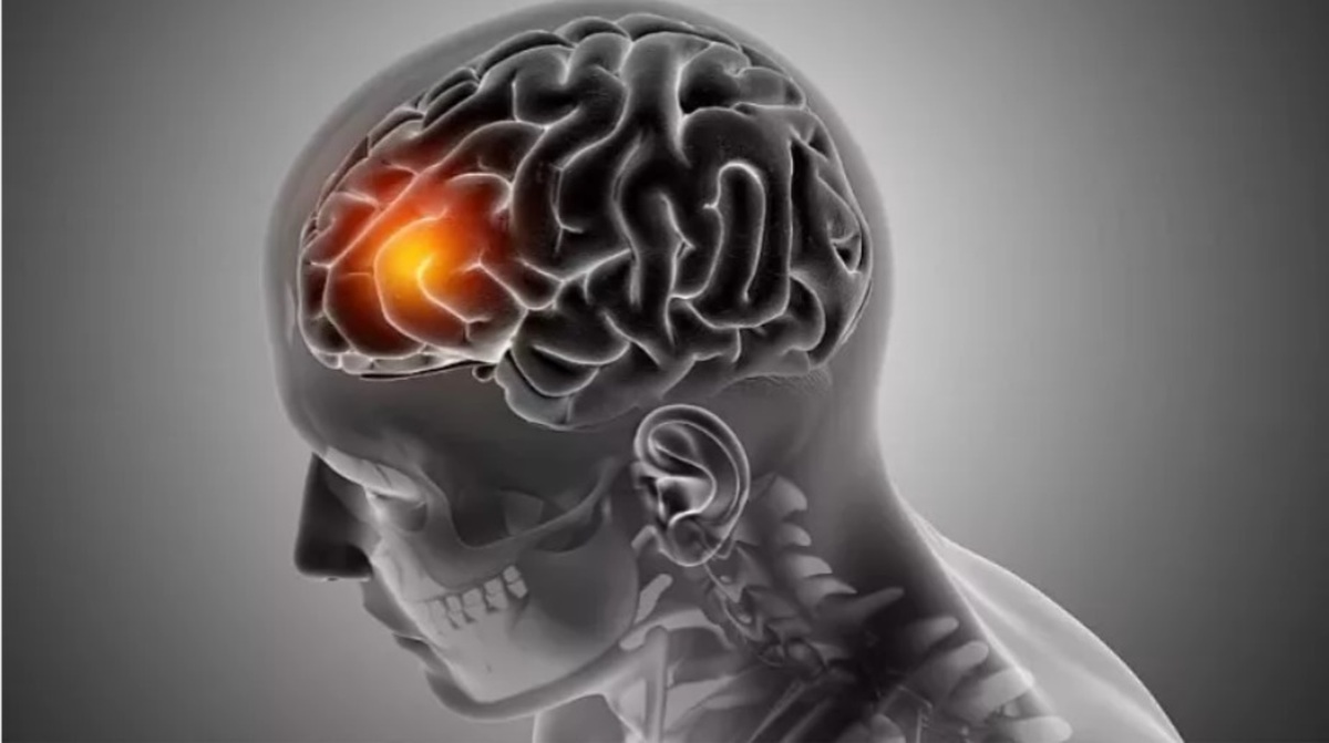 چرا پیشگیری از پیری مغز اهمیت دارد؟