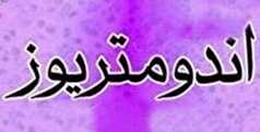 مکمل آنتی‌اکسیدانی «ان-استیل‌سیستئین»؛ امید تازه برای کاهش درد آندومتریوز