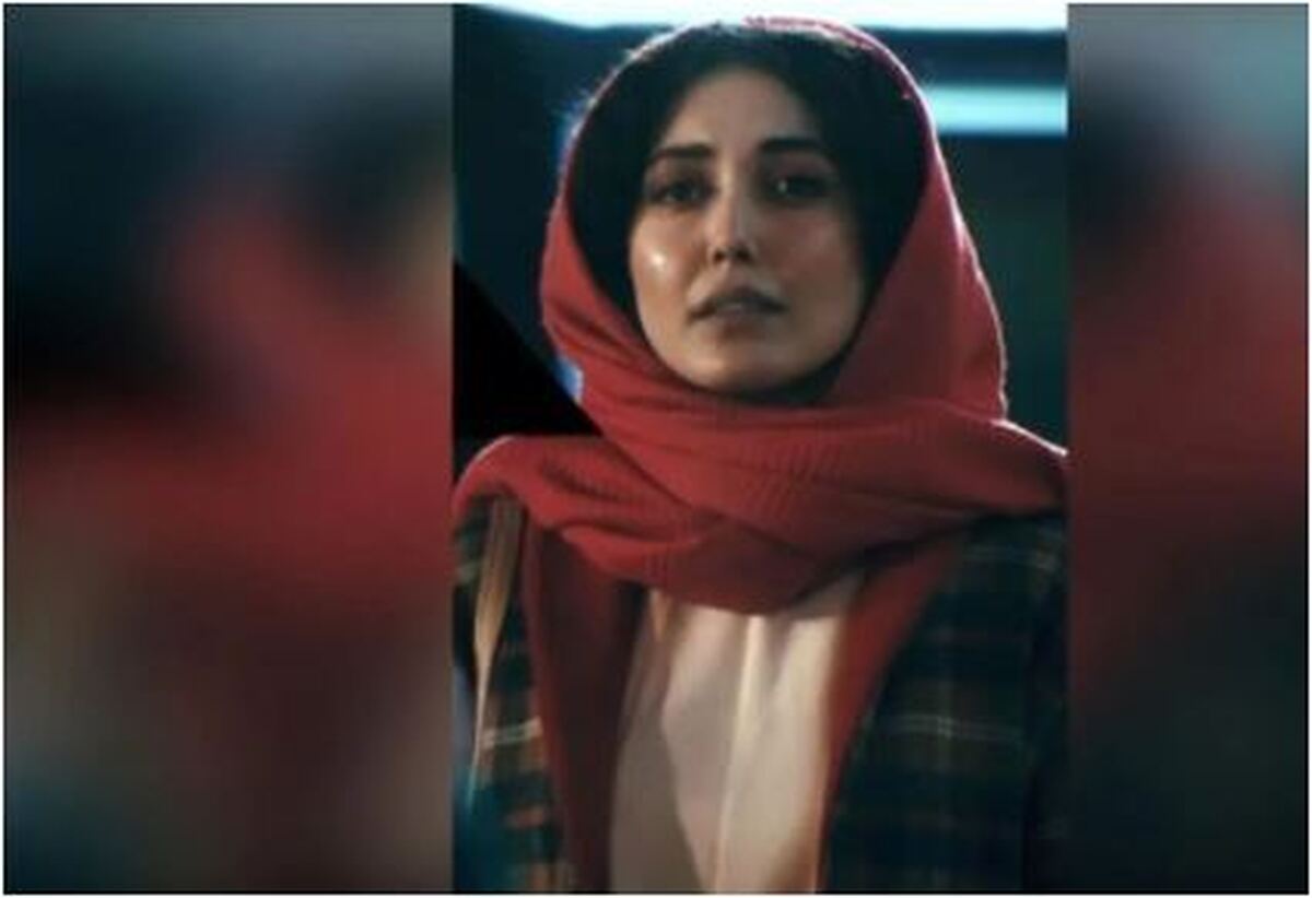 تغییر چهره دیدنی شادی خلیلی بعد از تزریق‌های فراوان را از دست ندهید! /چهره اش چطور شد؟