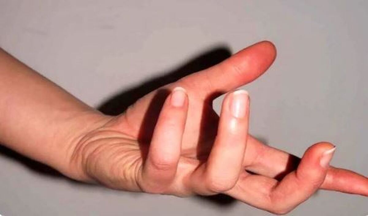 تشخیص اعتیاد به شیشه در یک نگاه!