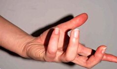 تشخیص اعتیاد به شیشه در یک نگاه!