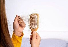 با پرهیز از این مواد خوراکی مو‌های سالم داشته باشید