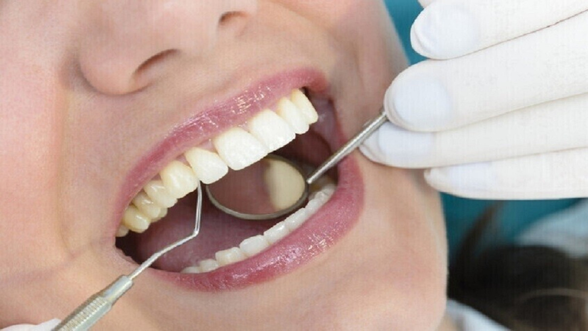 از کجا بفهمیم باید به متخصص ارتودنسی مراجعه کنیم؟