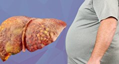 دارو‌های جدید آگونیست برای مقابله با کبد چرب