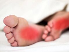 راه کار‌های طب سنتی برای رفع داغی کف پا