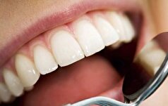 از کجا بفهمیم باید به متخصص ارتودنسی مراجعه کنیم؟