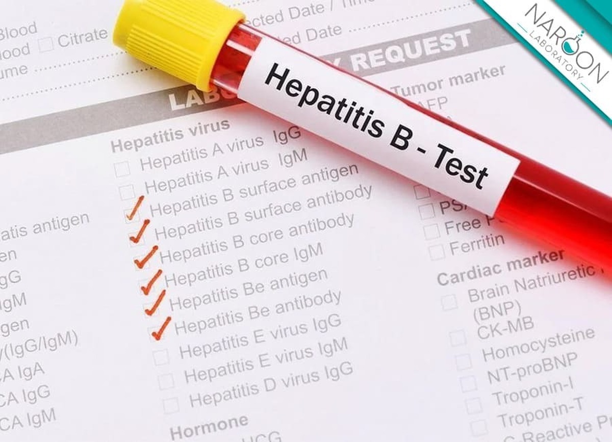 درمان و تشخیص هپاتیت در کشور رایگان شد!