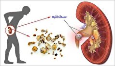 مصرف همزمان چند دارو خطر آسیب کلیوی دارد!