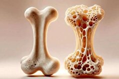 با خوردن آلو از پوکی استخوان فرار کنید